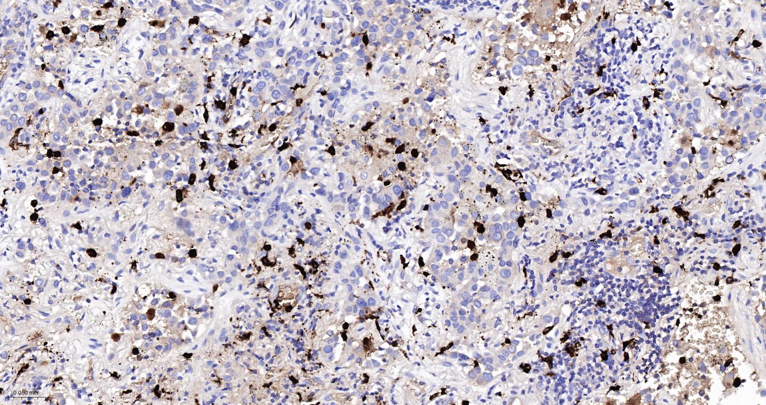 S100钙结合蛋白A8重组兔单抗