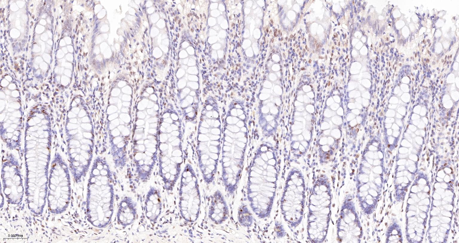 蛋白酪氨酸激酶BAP135重组兔单抗
