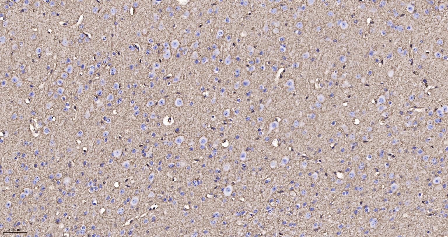 水通道蛋白4重组兔单抗