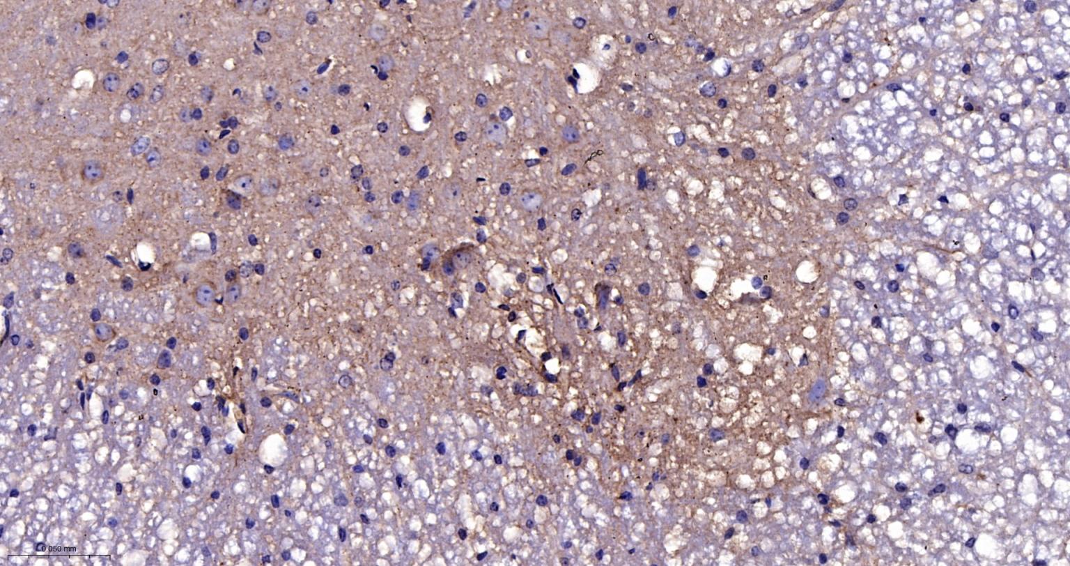 老年痴呆相关类钙粘蛋白CS1重组兔单抗