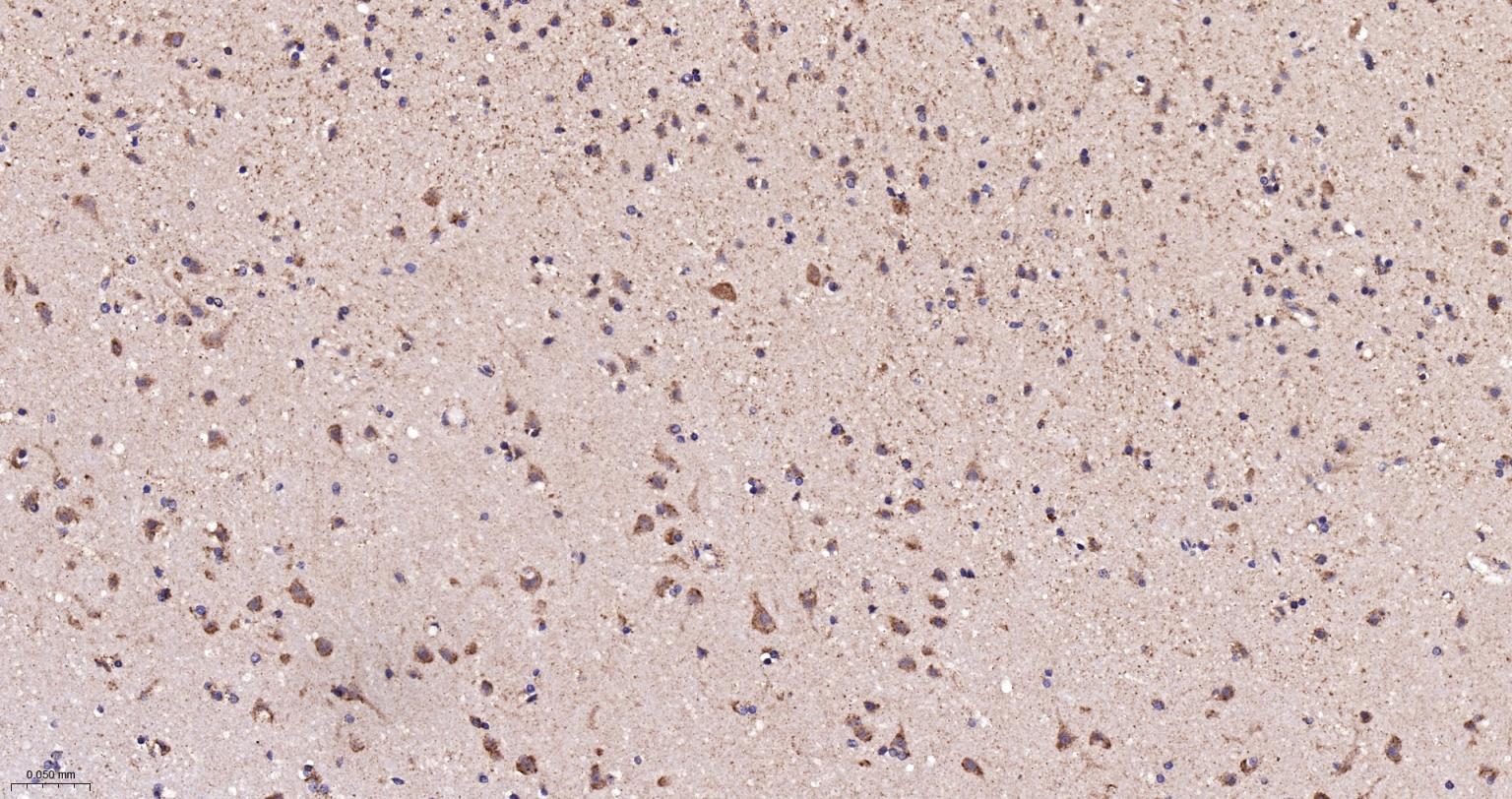 线粒体硫氧还蛋白2重组兔单抗