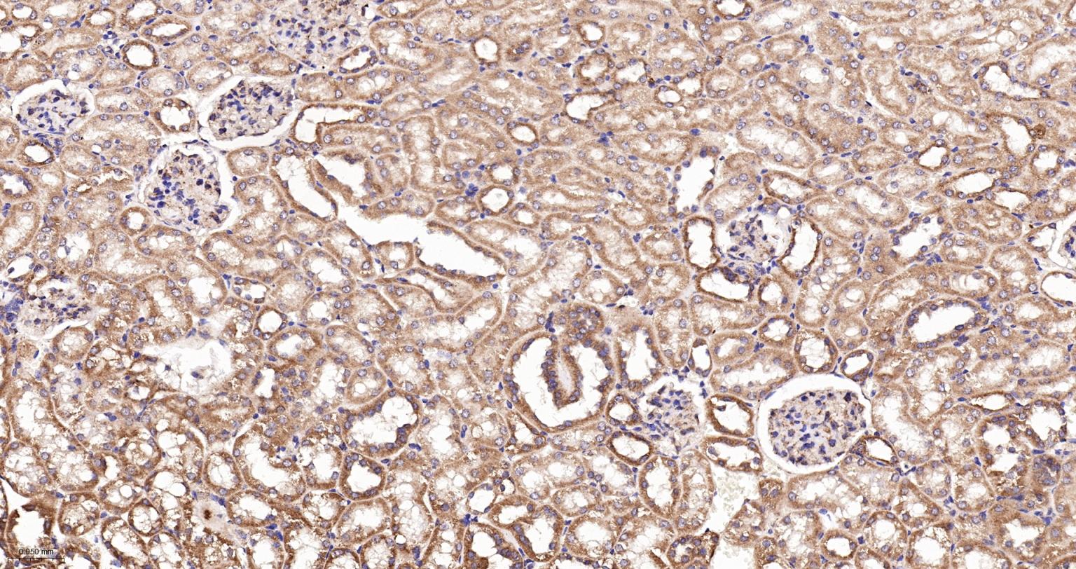 线粒体硫氧还蛋白2重组兔单抗