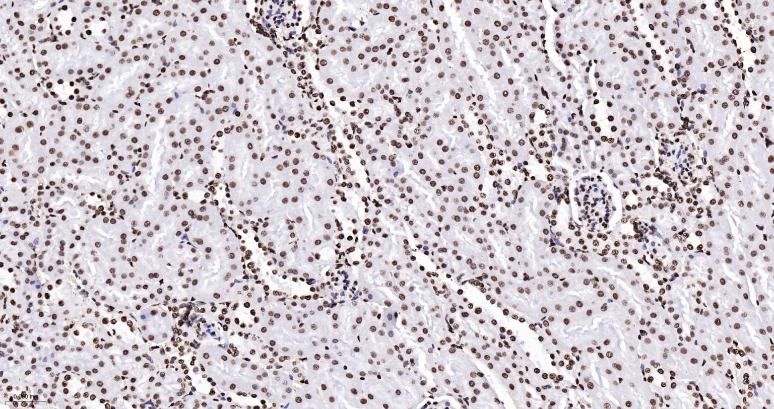 组蛋白H2AX重组兔单抗