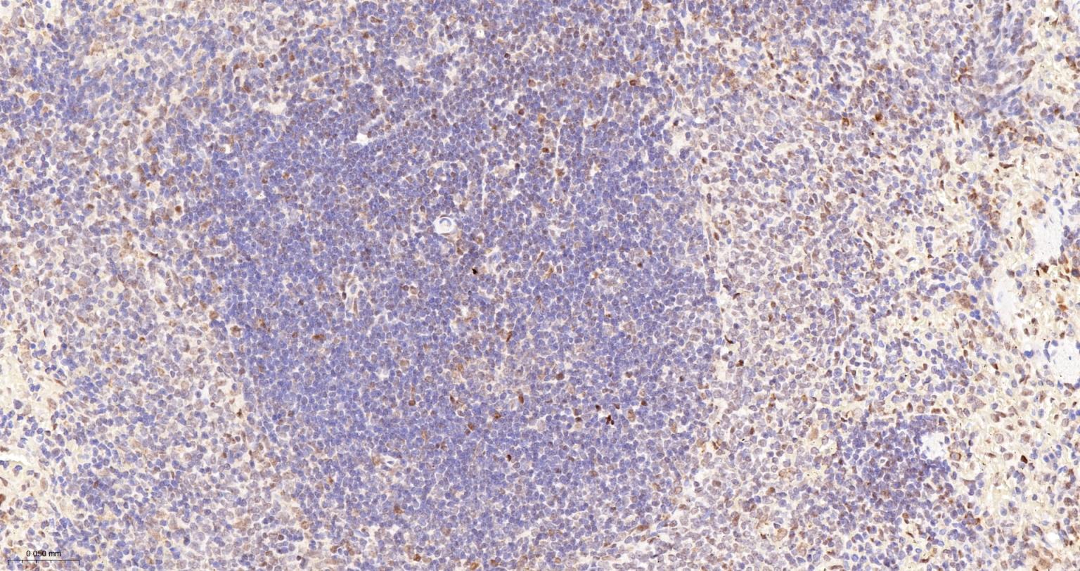 蛋白酪氨酸激酶BAP135重组兔单抗