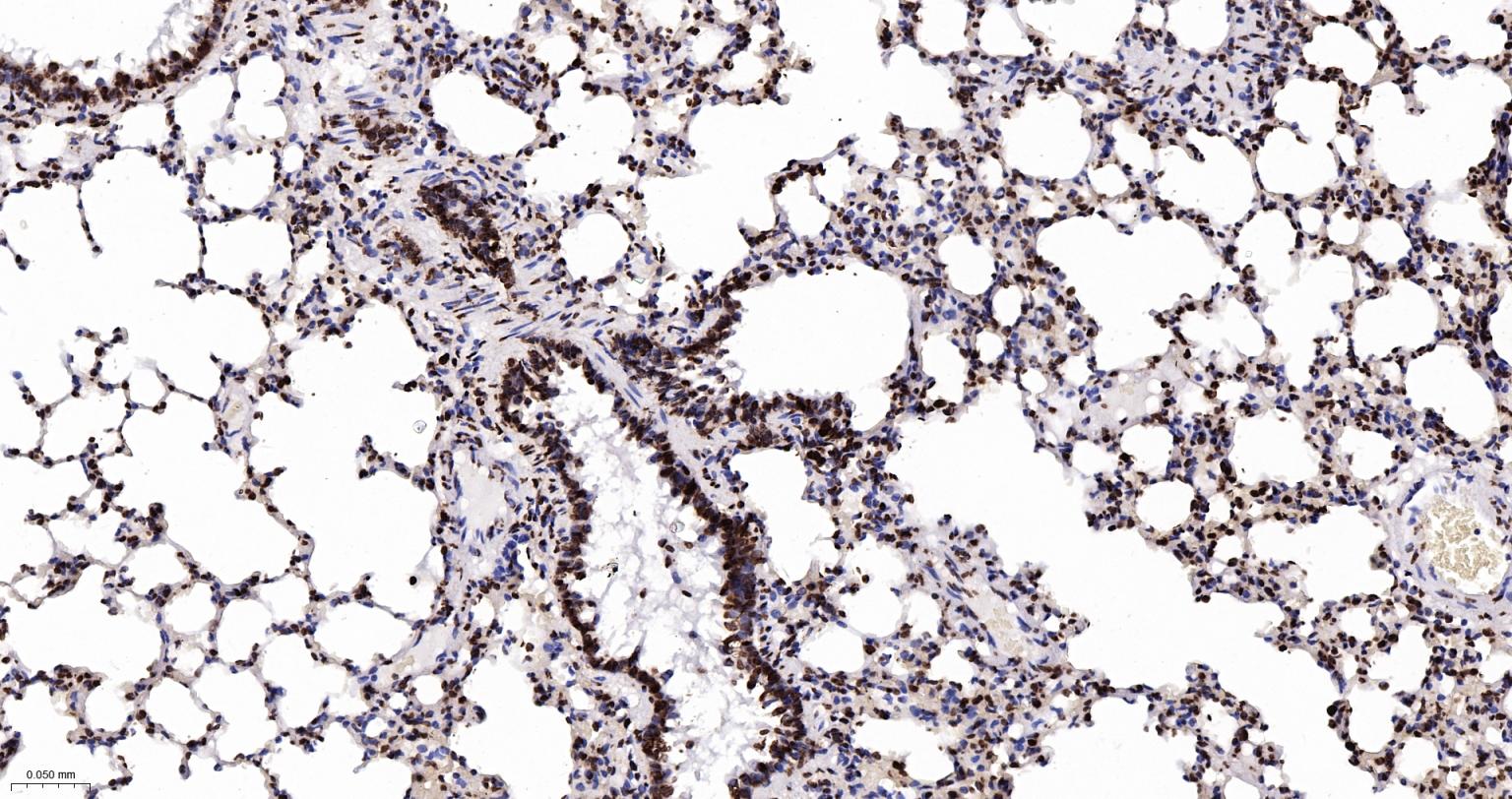 组蛋白H2AX重组兔单抗