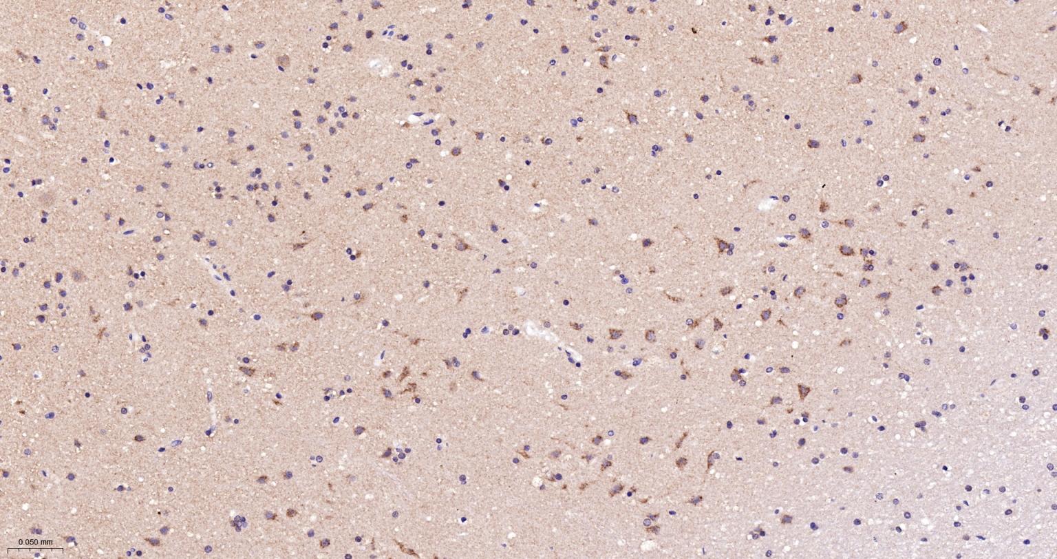 老年痴呆相关类钙粘蛋白CS1重组兔单抗