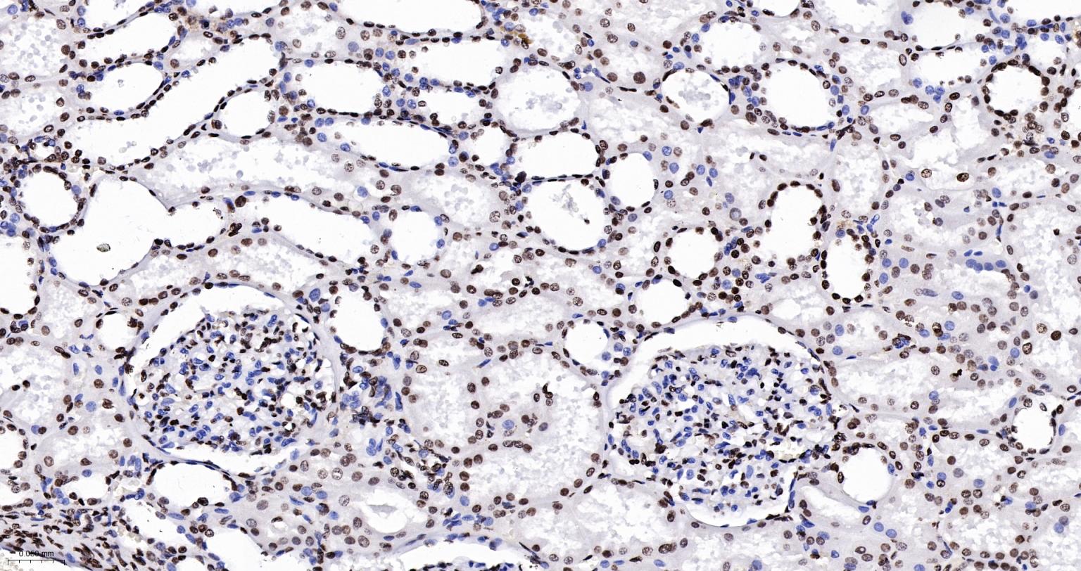 组蛋白H2AX重组兔单抗
