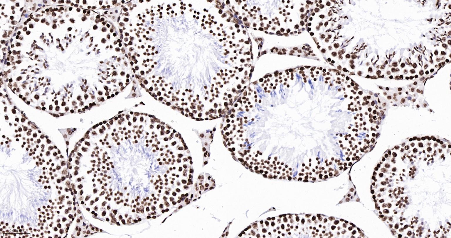组蛋白H2AX重组兔单抗