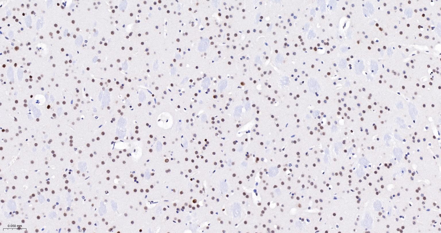 蛋白酪氨酸激酶BAP135重组兔单抗