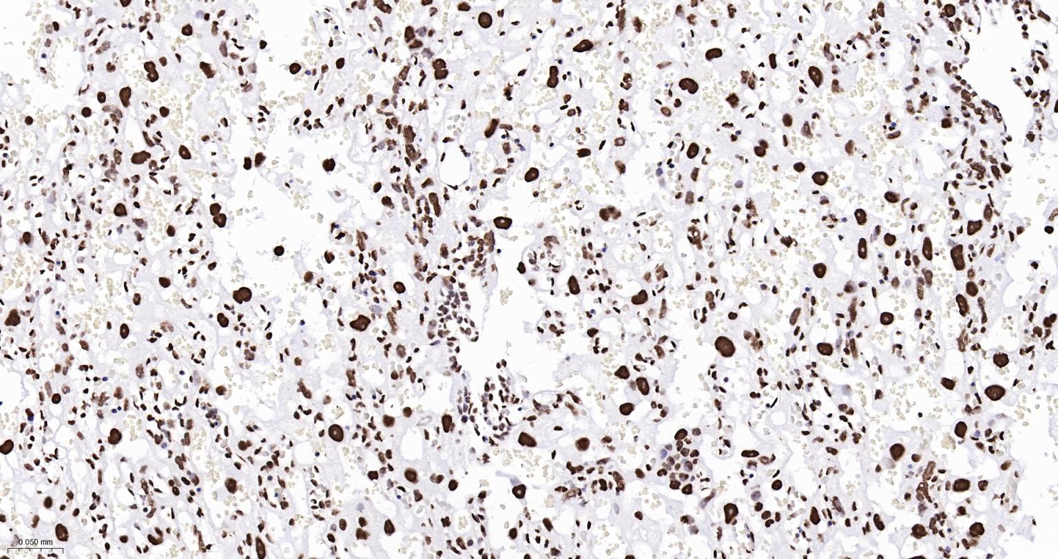 组蛋白H2AX重组兔单抗