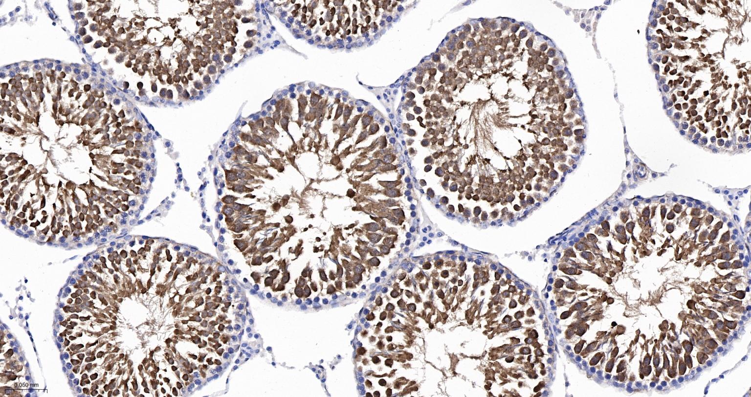 热休克蛋白-70重组兔单抗