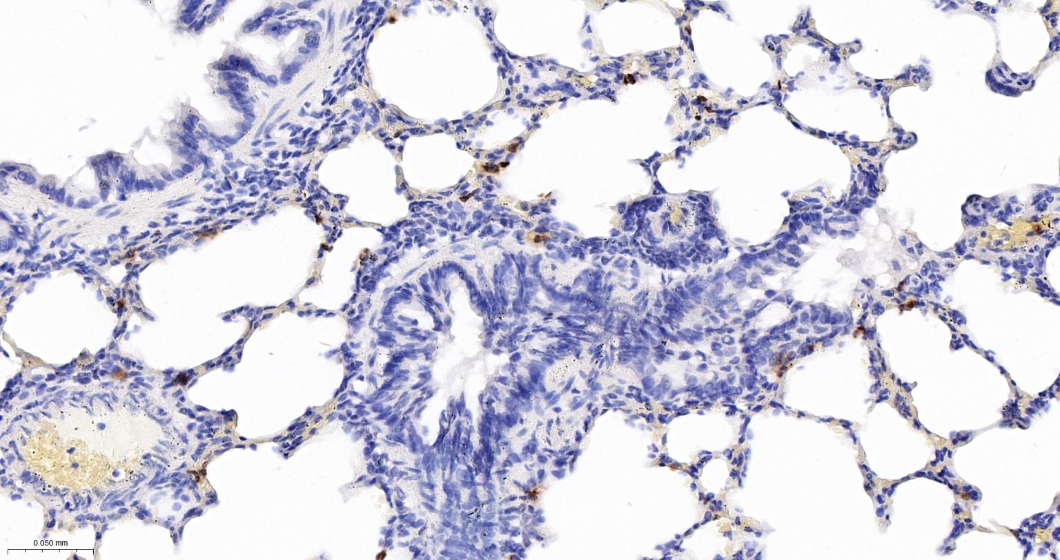 S100钙结合蛋白A8重组兔单抗