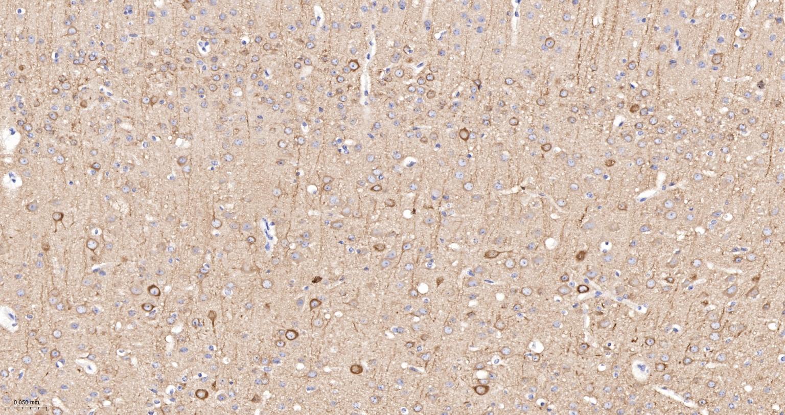 微管蛋白β3（神经标志物）单克隆抗体-bsm-33177M