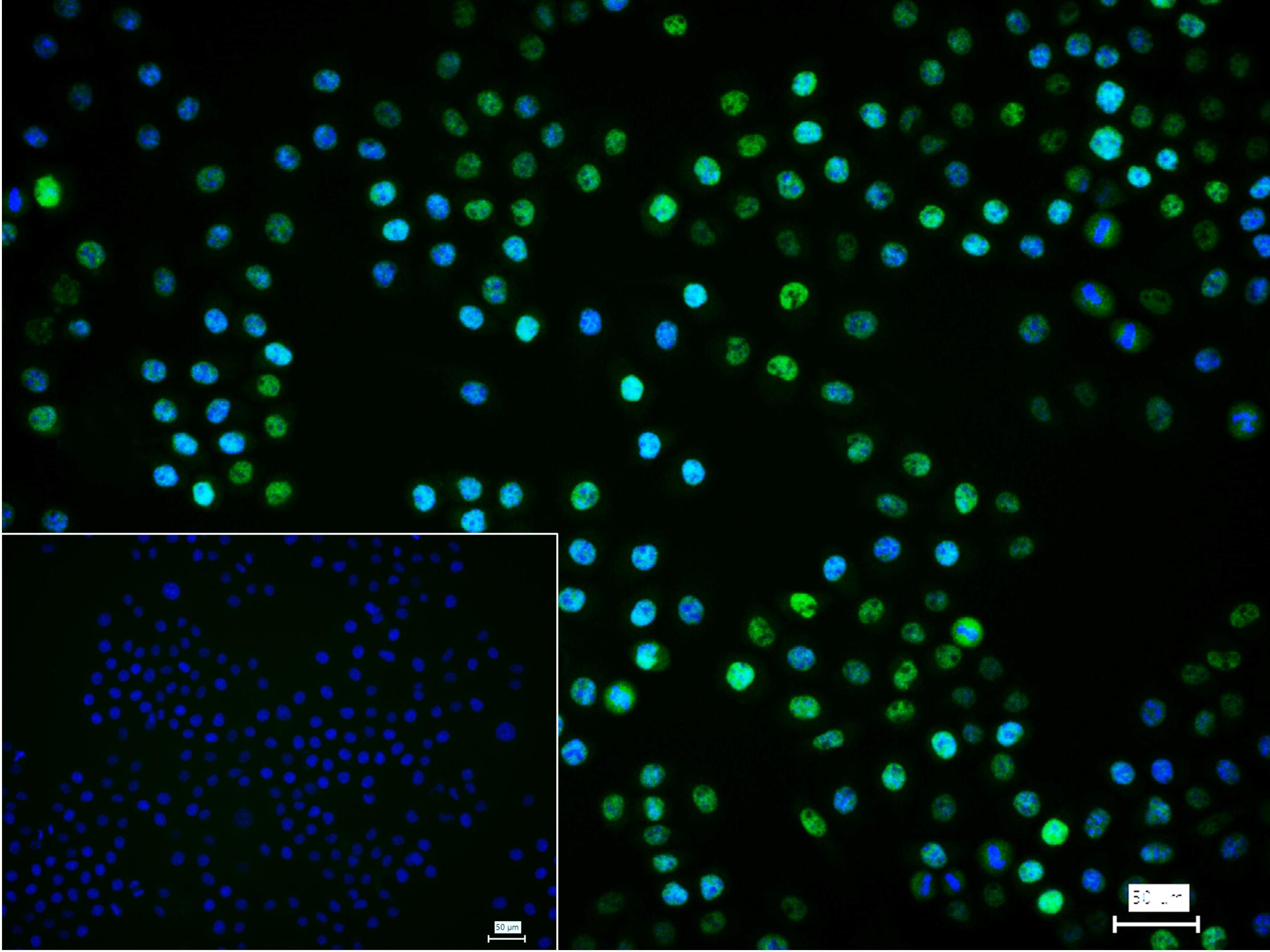 错配修复蛋白2重组兔单抗