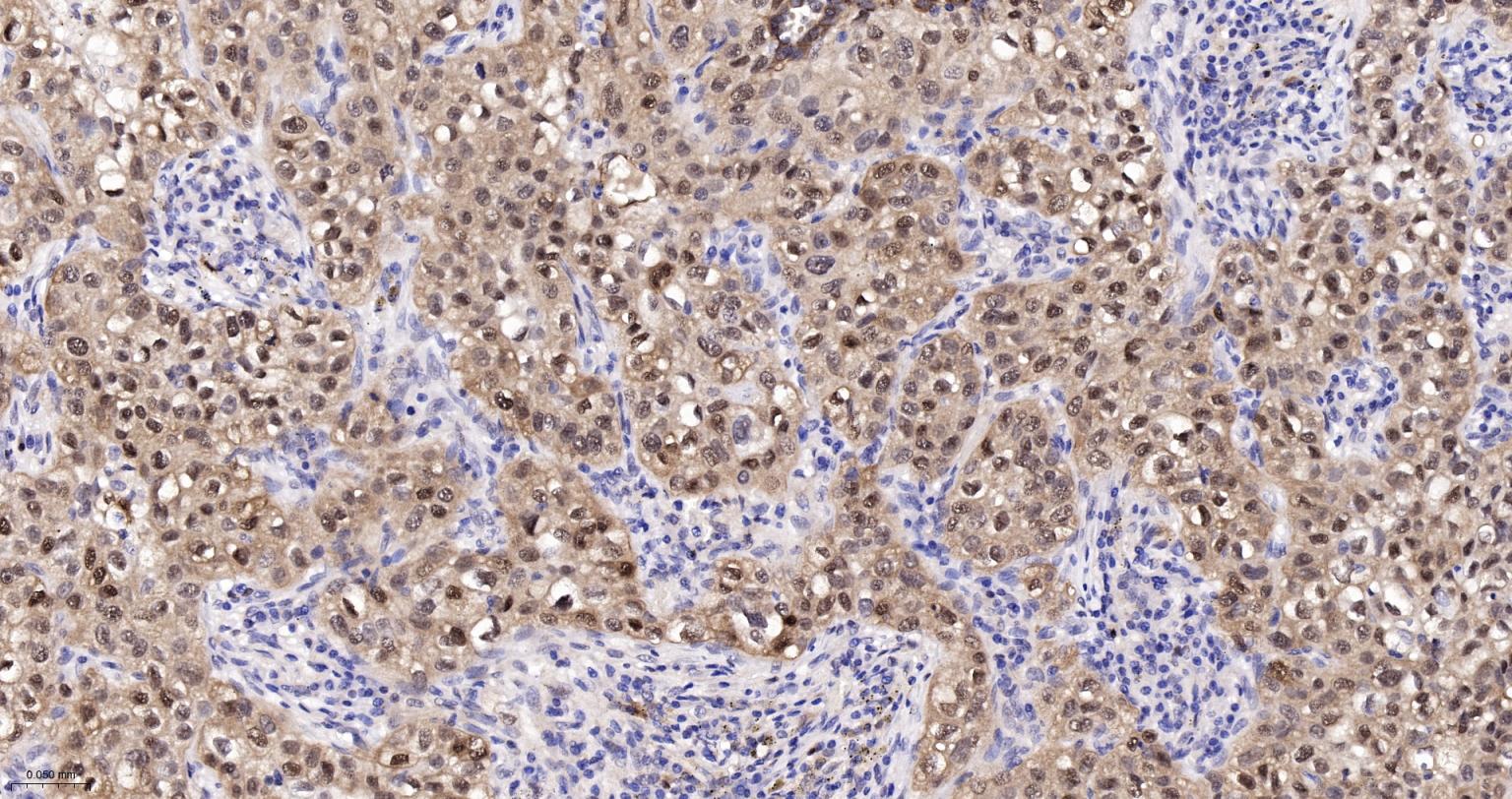 热休克蛋白-70重组兔单抗