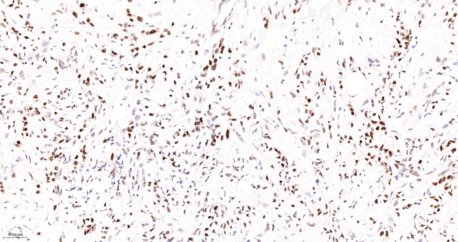 蛋白酪氨酸激酶BAP135重组兔单抗