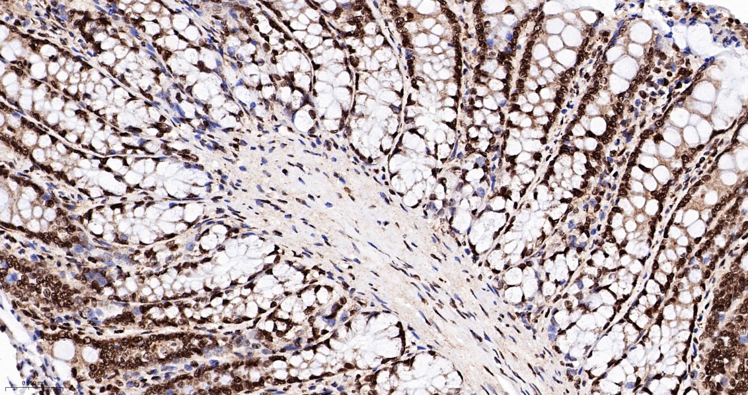 异型组蛋白H2A.1重组兔单抗-bsm-61665R