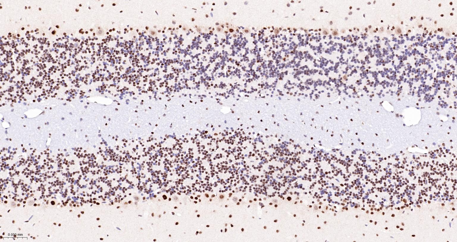 蛋白酪氨酸激酶BAP135重组兔单抗