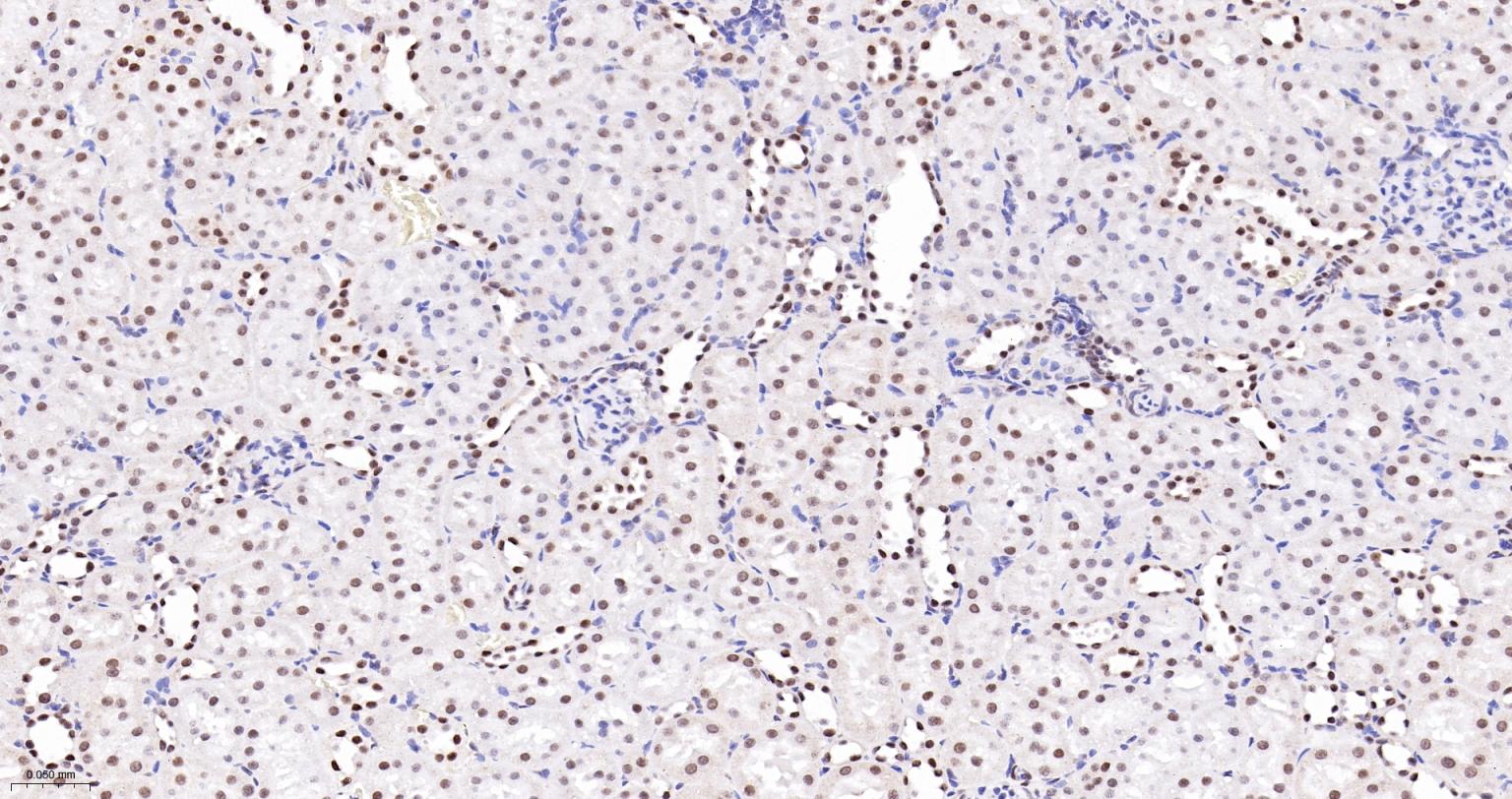 蛋白酪氨酸激酶BAP135重组兔单抗