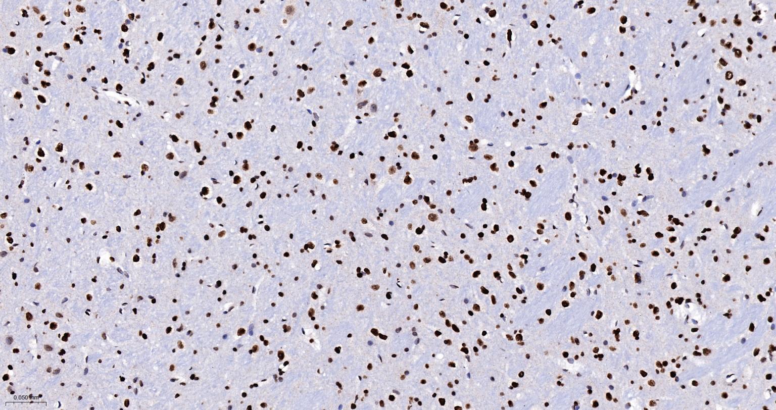 异型组蛋白H2A.1重组兔单抗-bsm-61665R