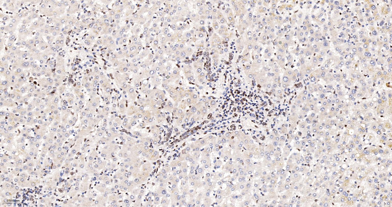 异型组蛋白H2A.1重组兔单抗-bsm-61665R