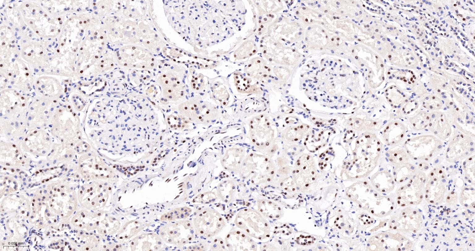 蛋白酪氨酸激酶BAP135重组兔单抗