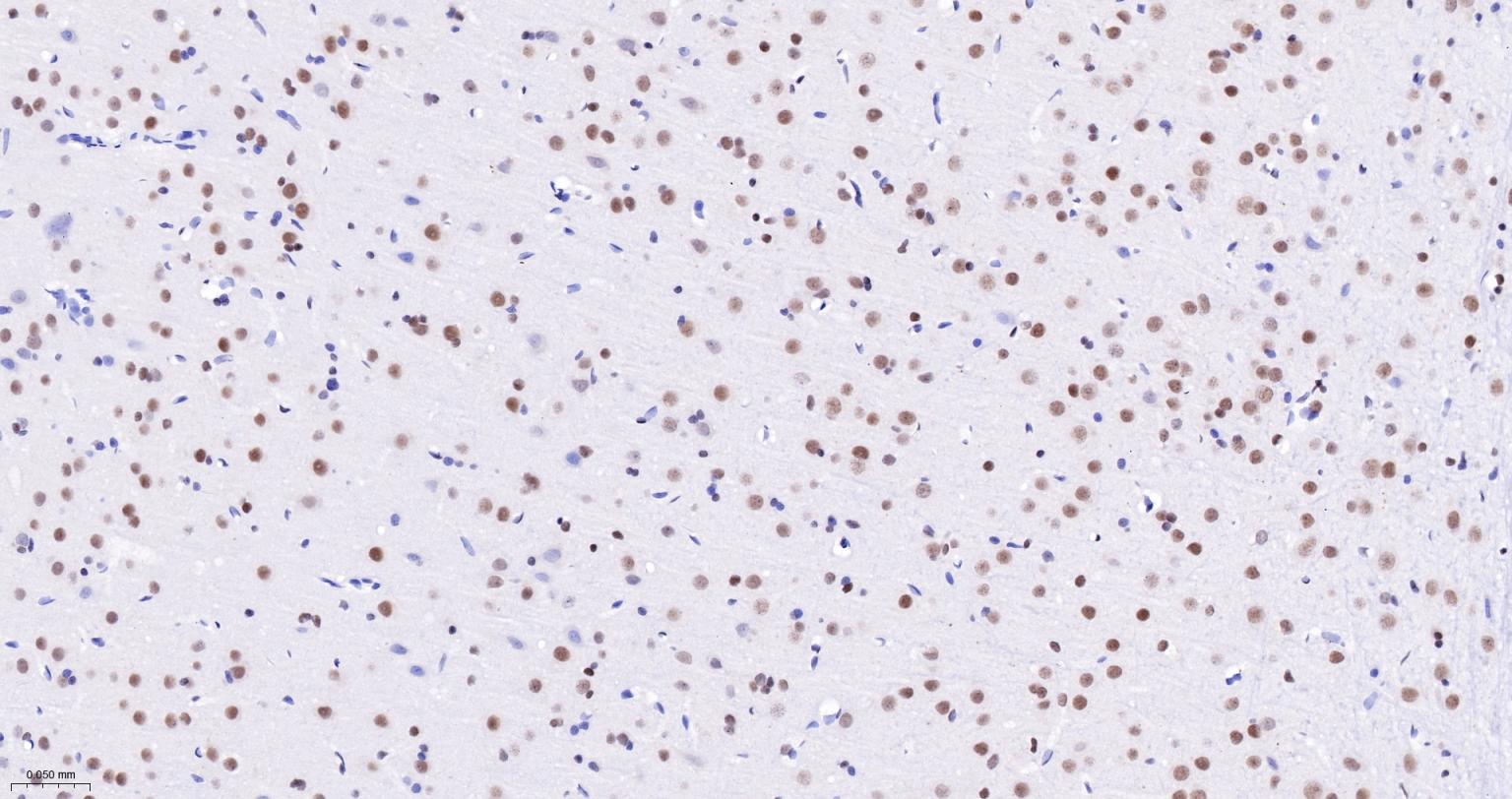 蛋白酪氨酸激酶BAP135重组兔单抗