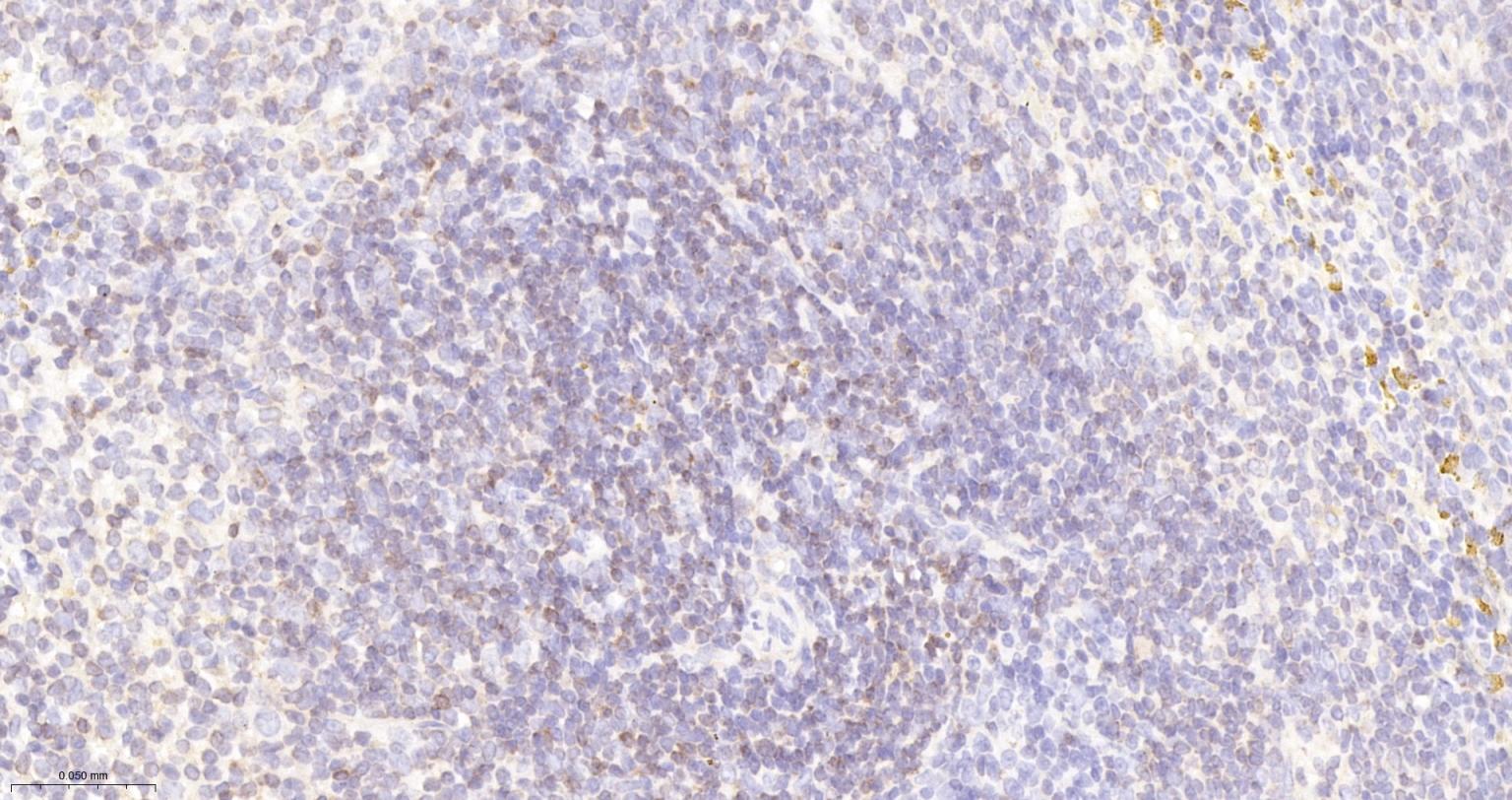 Bcl-2重组兔单抗