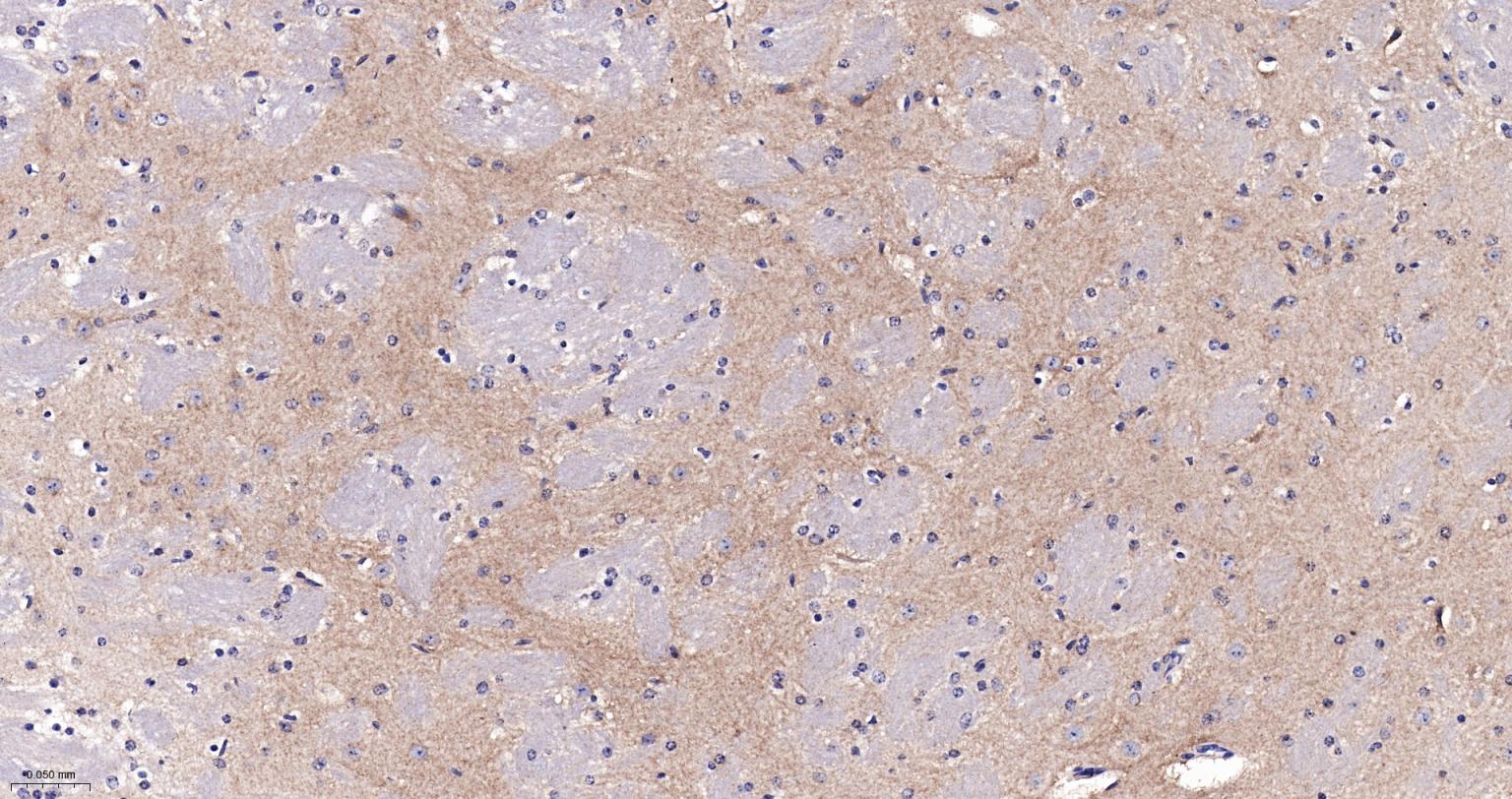 老年痴呆相关类钙粘蛋白CS1重组兔单抗