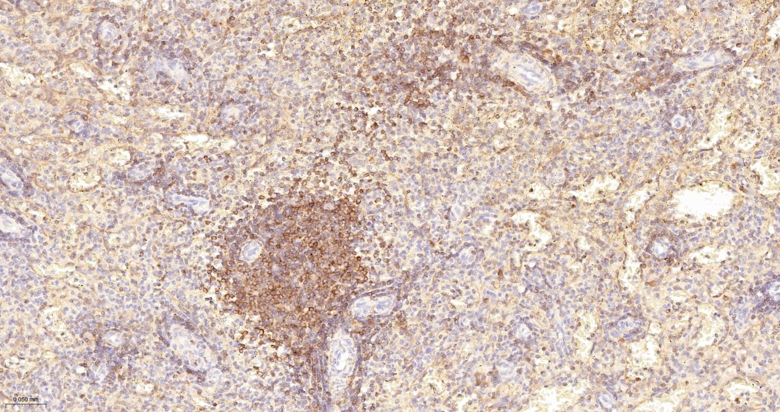 Bcl-2重组兔单抗