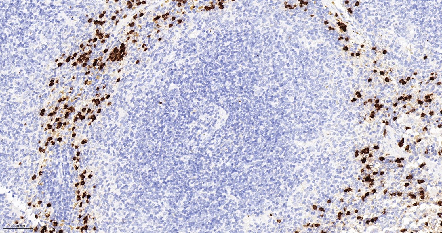 S100钙结合蛋白A8重组兔单抗