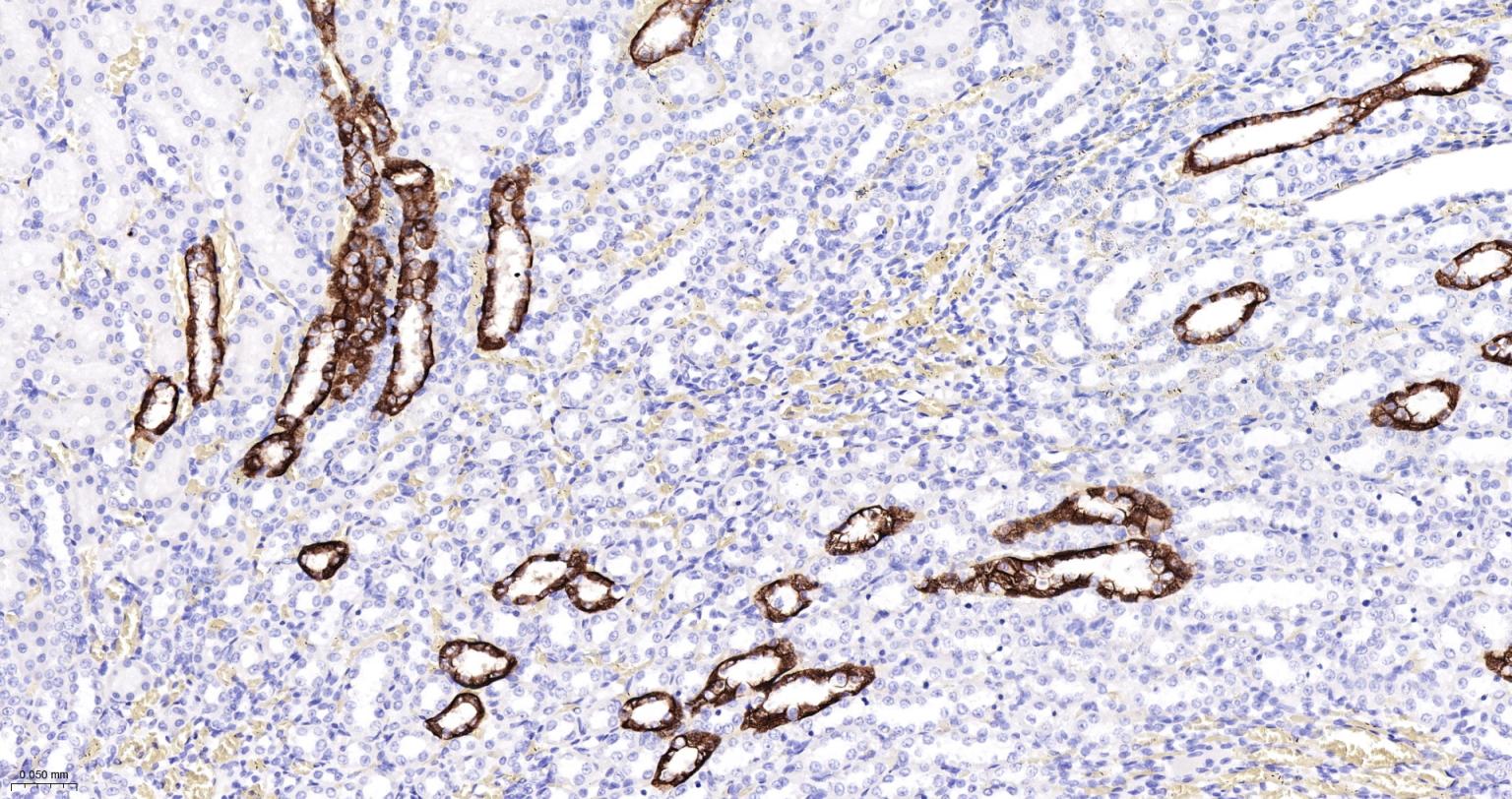 水通道蛋白4重组兔单抗