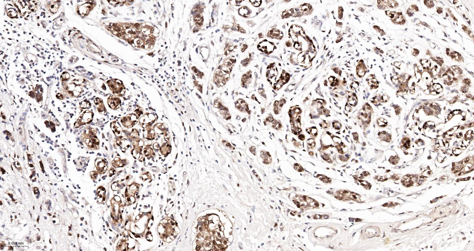 热休克蛋白-70重组兔单抗