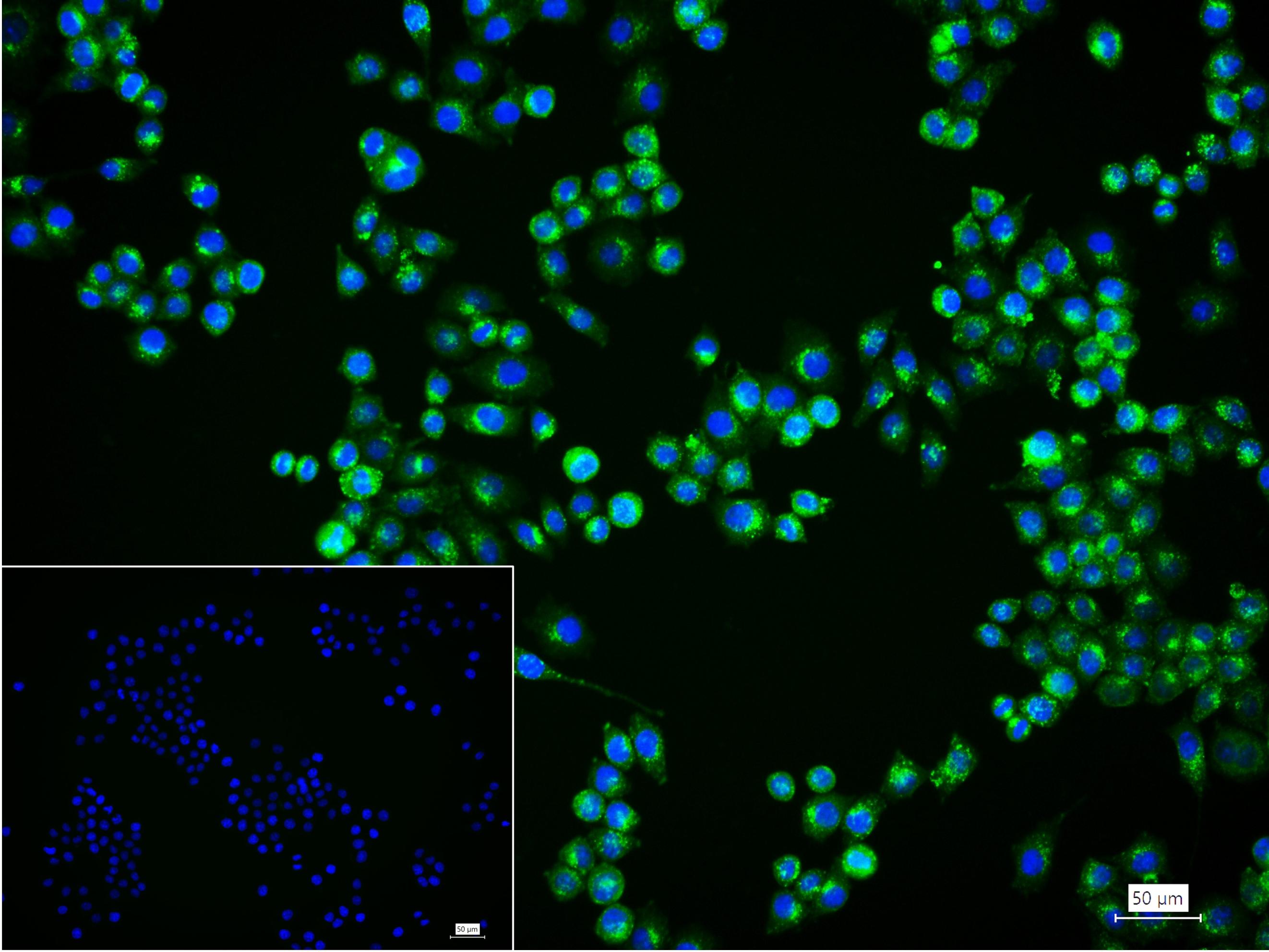 溶酶体相关膜蛋白1（CD107）重组兔单抗