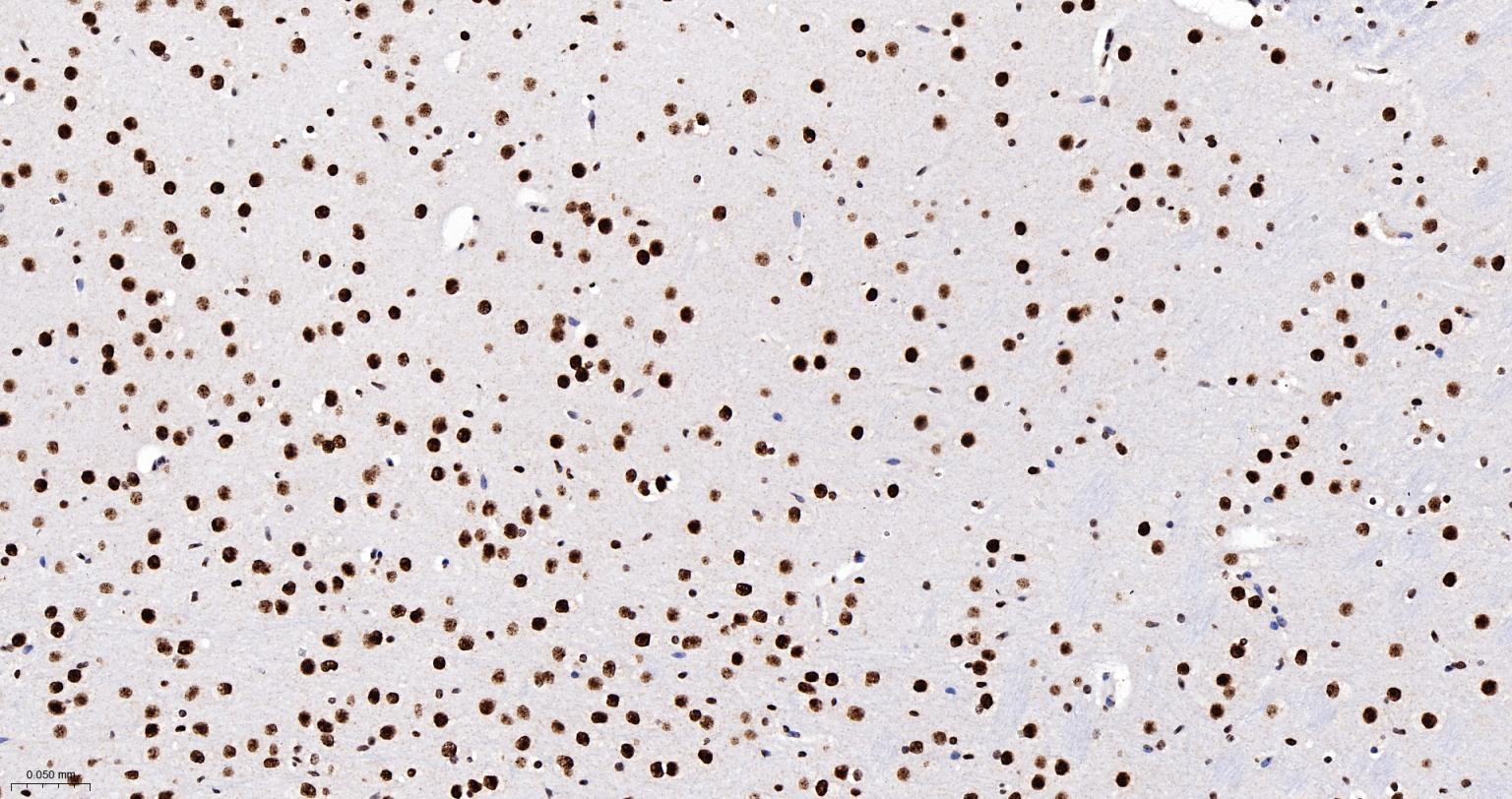 异型组蛋白H2A.1重组兔单抗-bsm-61665R