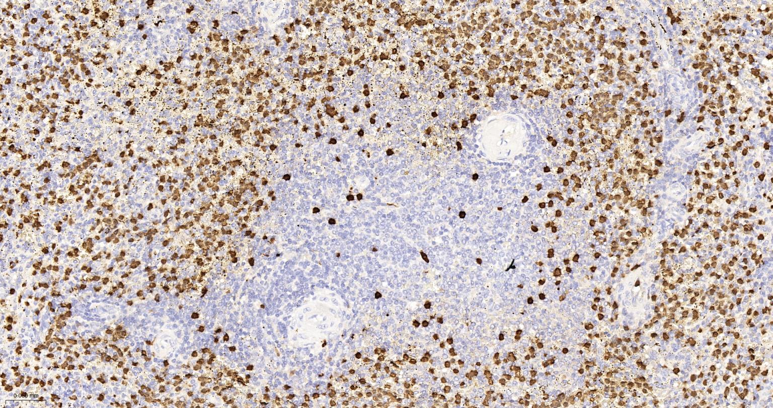 S100钙结合蛋白A8重组兔单抗