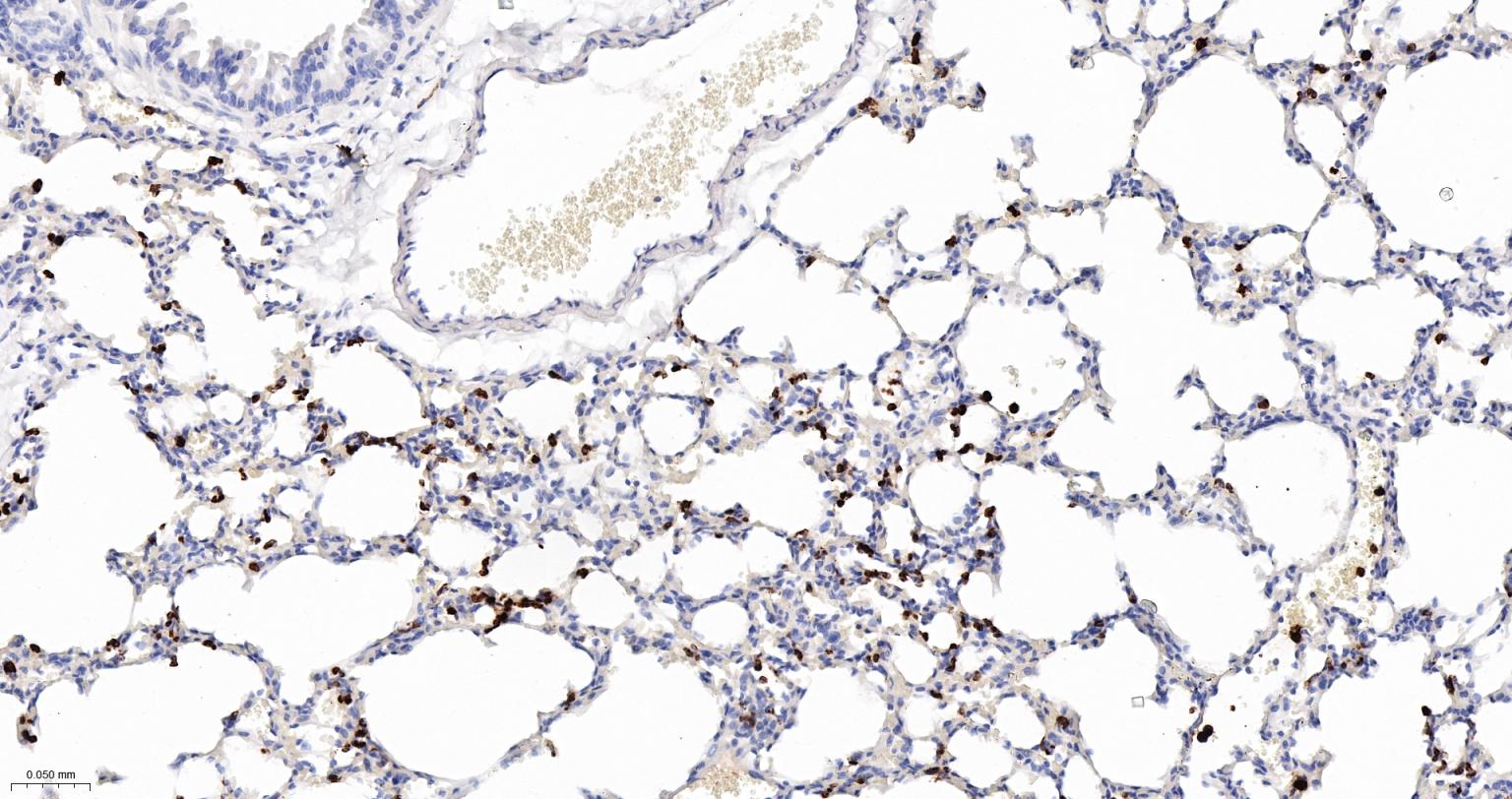 S100钙结合蛋白A8重组兔单抗