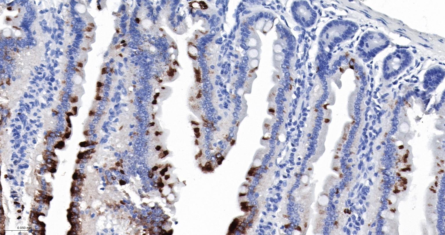 S100钙结合蛋白A8重组兔单抗