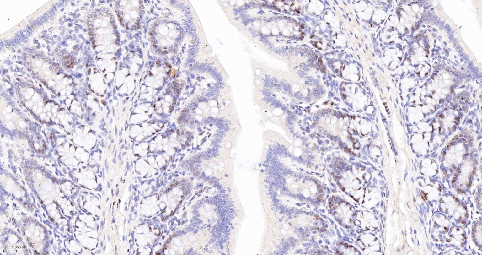蛋白酪氨酸激酶BAP135重组兔单抗