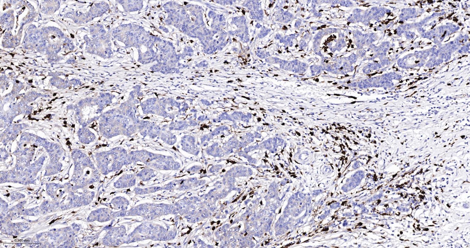 S100钙结合蛋白A8重组兔单抗