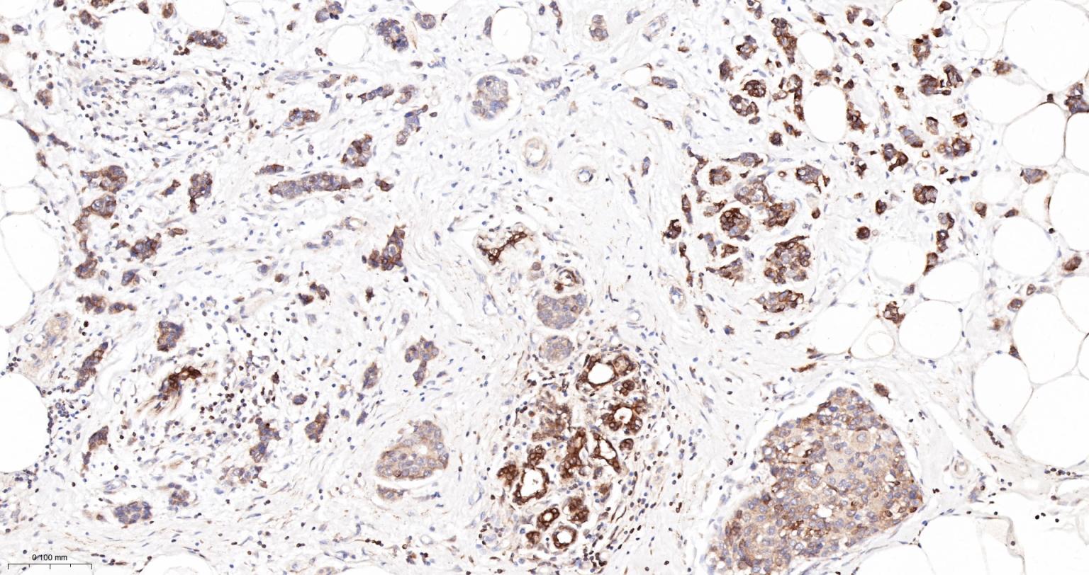 Bcl-2重组兔单抗