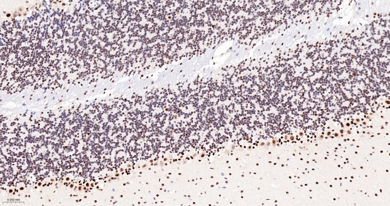 蛋白酪氨酸激酶BAP135重组兔单抗