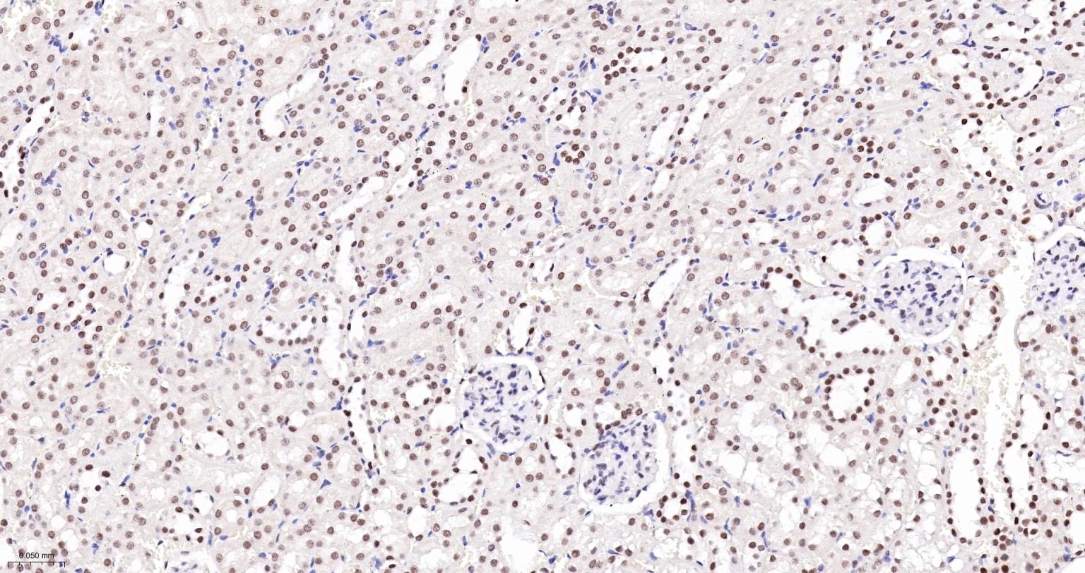 蛋白酪氨酸激酶BAP135重组兔单抗