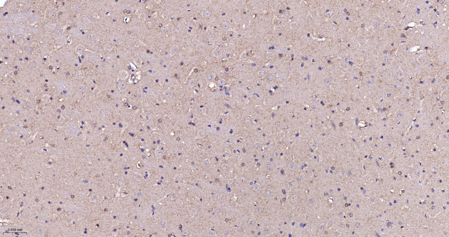 老年痴呆相关类钙粘蛋白CS1重组兔单抗