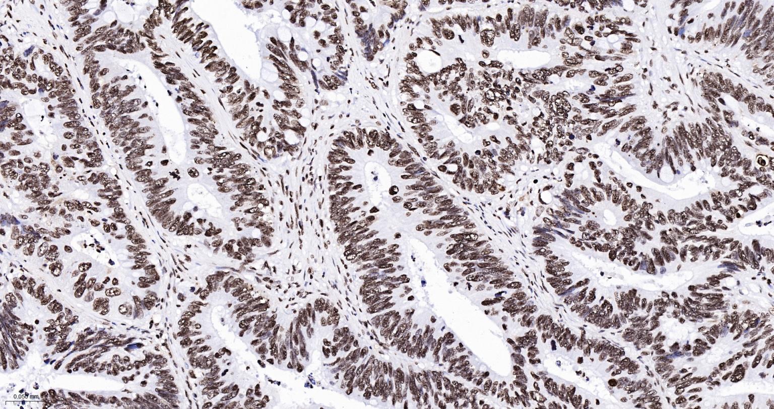 组蛋白H2AX重组兔单抗