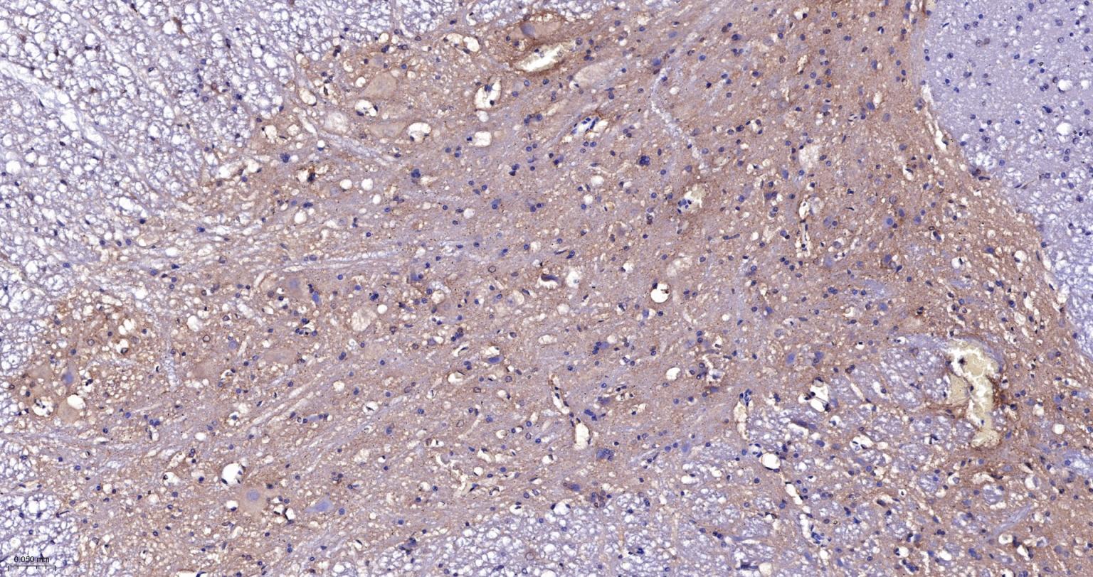 老年痴呆相关类钙粘蛋白CS1重组兔单抗