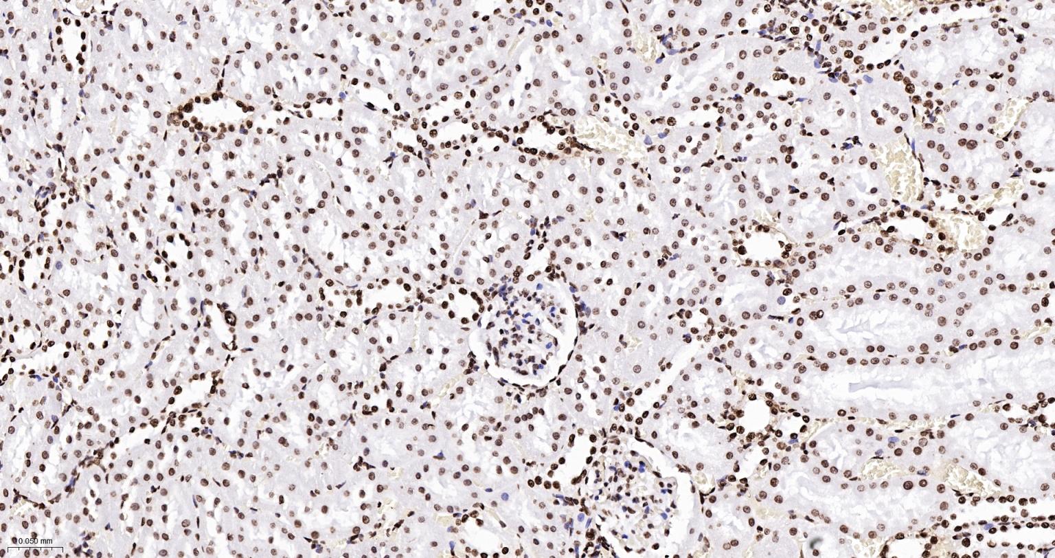 组蛋白H2AX重组兔单抗