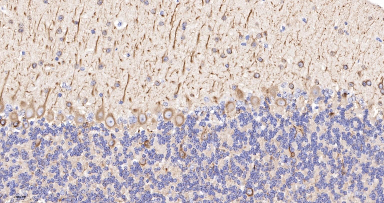微管蛋白β3（神经标志物）单克隆抗体-bsm-33177M