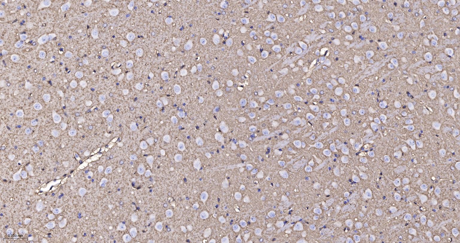 水通道蛋白4重组兔单抗