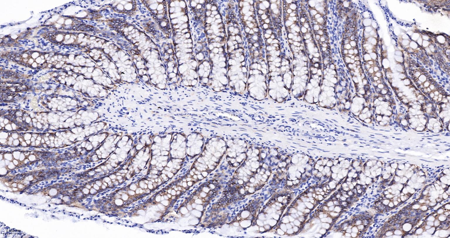 整合素α2（CD49b）重组兔单抗